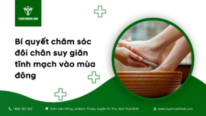 Bí quyết chăm sóc đôi chân suy giãn tĩnh mạch vào mùa đông