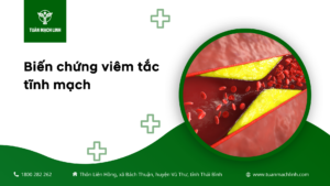 Biến chứng viêm tắc tĩnh mạch