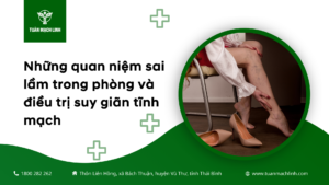 Những quan niệm sai lầm trong phòng và điều trị suy giãn tĩnh mạch