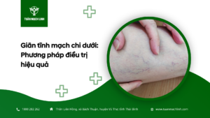 Giãn tĩnh mạch chi dưới: Phương pháp điều trị hiệu quả