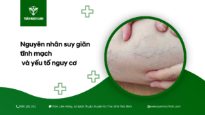 Nguyên nhân suy giãn tĩnh mạch và yếu tố nguy cơ