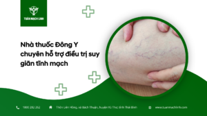 Nhà thuốc Đông Y chuyên hỗ trợ điều trị suy giãn tĩnh mạch