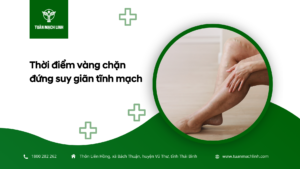 Thời điểm vàng chặn đứng suy giãn tĩnh mạch