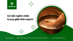 Có nên ngâm chân trị suy giãn tĩnh mạch