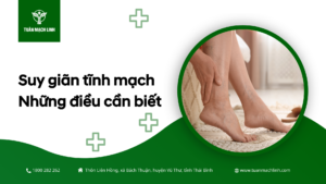 Suy giãn tĩnh mạch - Những điều cần biết