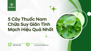 5 Cây Thuốc Nam Chữa Suy Giãn Tĩnh Mạch Hiệu Quả Nhất