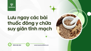 Lưu ngay các bài thuốc đông y chữa suy giãn tĩnh mạch