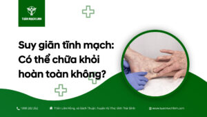 Suy giãn tĩnh mạch Có thể chữa khỏi hoàn toàn không