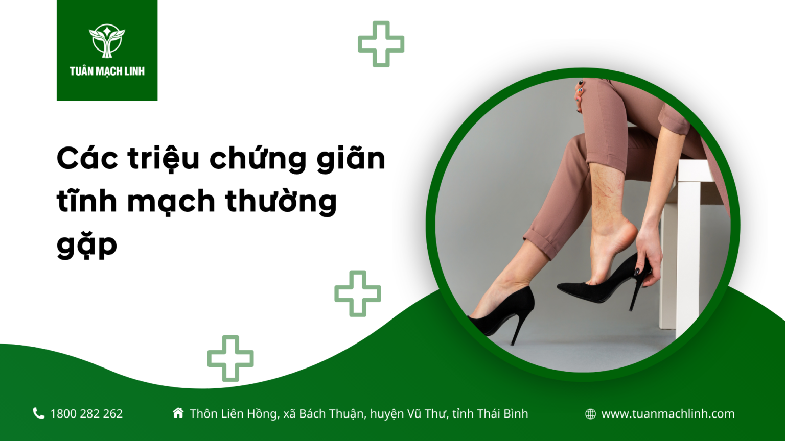 Các triệu chứng giãn tĩnh mạch thường gặp