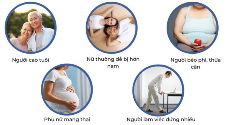 Những đối tượng dễ mắc bệnh suy giãn tĩnh mạch