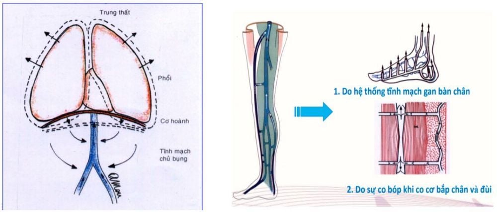 Trào ngược tĩnh mạch xảy ra khi có sự suy van tĩnh mạch