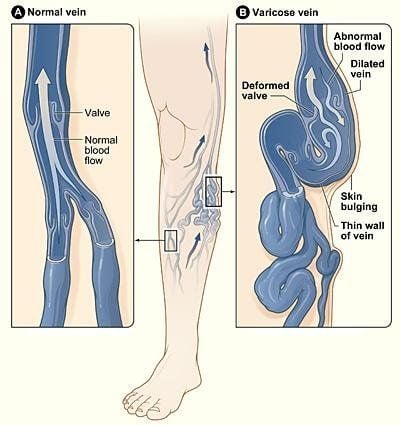 Hệ tĩnh mạch đảm bảo nhận máu từ ngoại biên đưa trở về tim