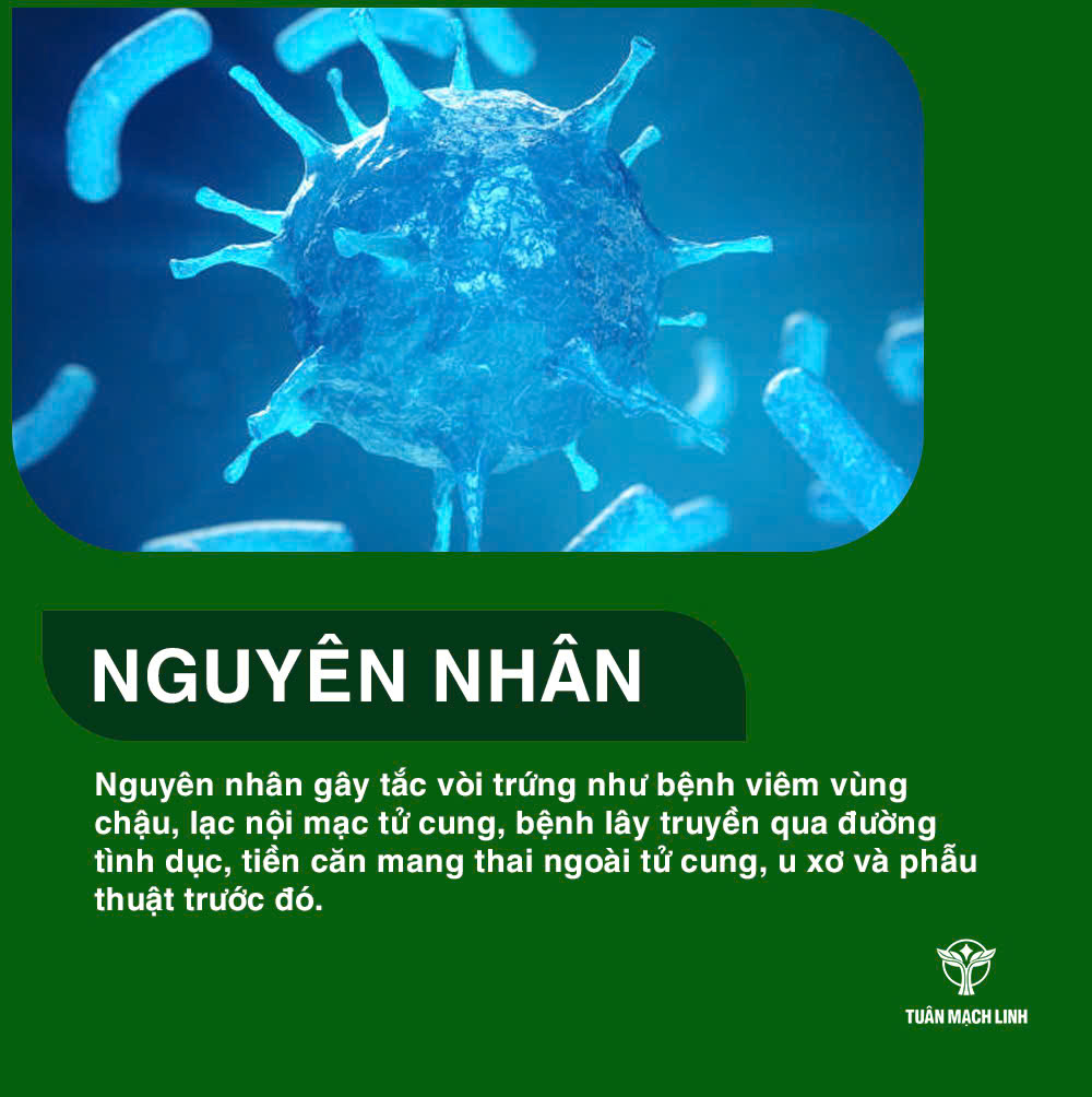 Nguyên nhân tắc vòi trứng