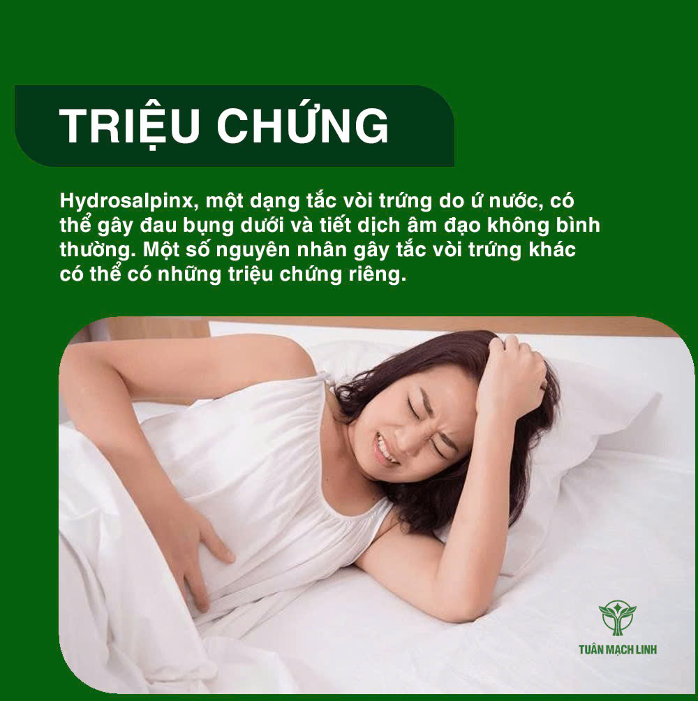 Tắc vòi trứng là gì? Nguyên nhân, triệu chứng, điều trị và cách phòng ngừa