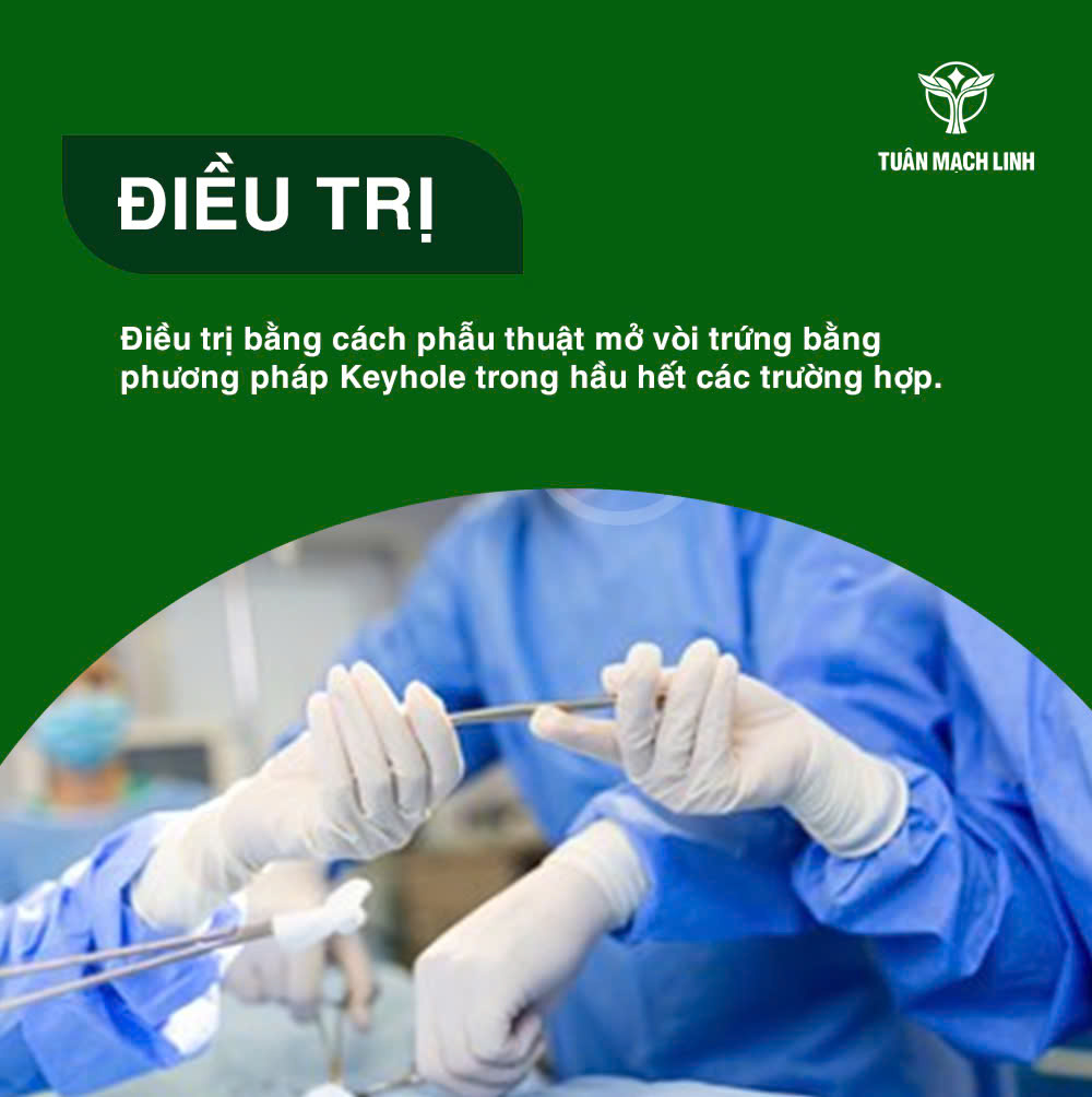 Phương pháp phòng ngừa tắc vòi trứng hiệu quả