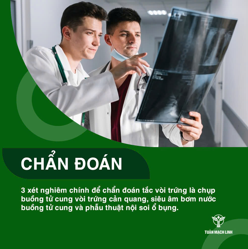 Phương pháp chẩn đoán & điều trị tắc vòi trứng